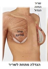 הגדלה מתחת לשריר