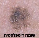 הסרת גידולי עור