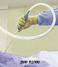 שאיבת שומן