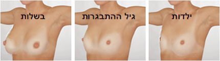 התפתחות השד