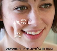 גומת חן