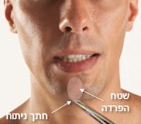 ניתוחים פלסטיים לגברים