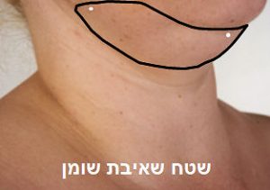 סנטר כפול