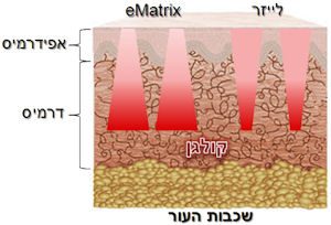 שכבות עור