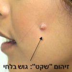 גוש בלחי