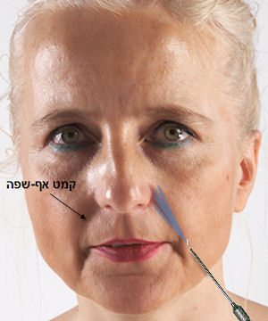 קמט אף-שפה