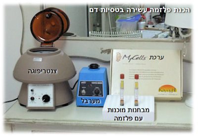 הכנה פלזמה עשירה בטסיות דם
