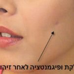 גומת חן