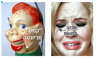 מילוי קמטים בפנים